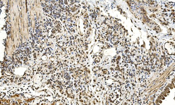 LSM2 Rabbit Polyclonal Antibody