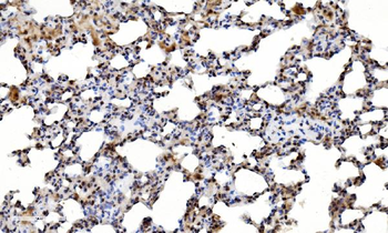 LSM2 Rabbit Polyclonal Antibody