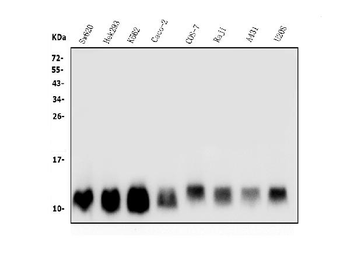 LSM2 Rabbit Polyclonal Antibody