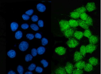 LSM2 Rabbit Polyclonal Antibody