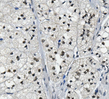 LSM2 Rabbit Polyclonal Antibody