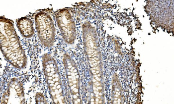 LSM2 Rabbit Polyclonal Antibody