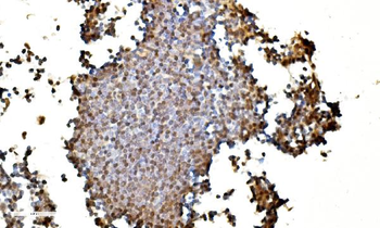 LSM2 Rabbit Polyclonal Antibody