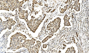 LSM2 Rabbit Polyclonal Antibody