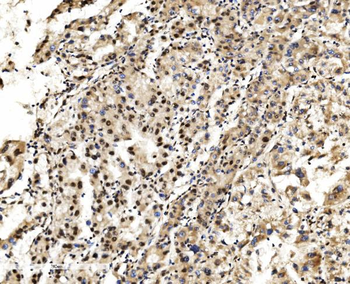 LSM2 Rabbit Polyclonal Antibody