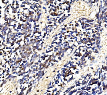 LSM2 Rabbit Polyclonal Antibody
