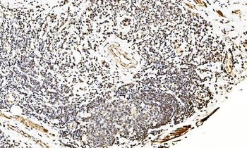 LSM2 Rabbit Polyclonal Antibody