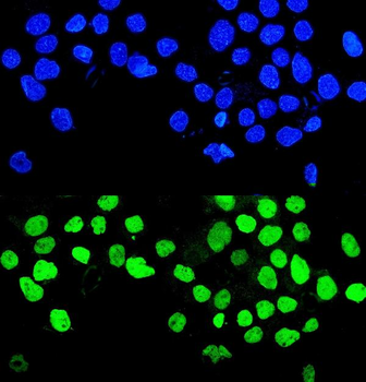 MMP28 Rabbit Polyclonal Antibody
