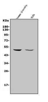 MMP28 Rabbit Polyclonal Antibody