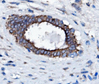 Slc25a1 Rabbit Polyclonal Antibody