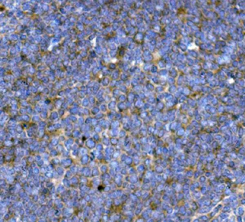 BCMA/Tnfrsf17 Rabbit Polyclonal Antibody