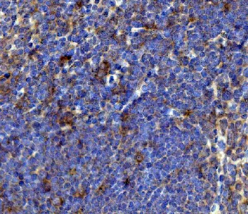 BCMA/Tnfrsf17 Rabbit Polyclonal Antibody