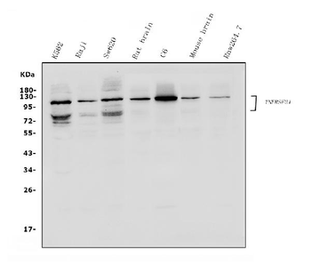 DR6/TNFRSF21 Rabbit Polyclonal Antibody