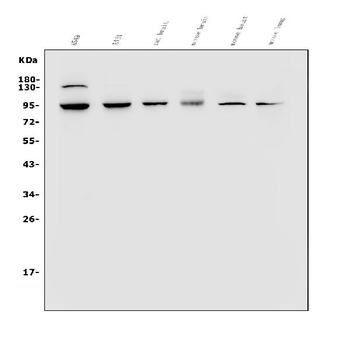 VRL1/TRPV2 Rabbit Polyclonal Antibody