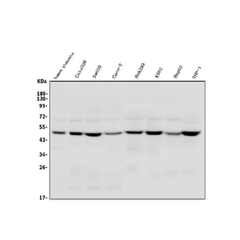 TSG101 Rabbit Polyclonal Antibody