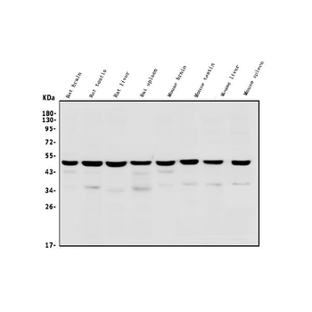 TSG101 Rabbit Polyclonal Antibody