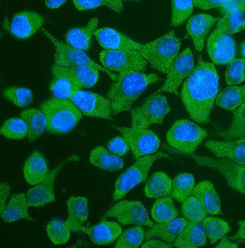 YTHDF2 Rabbit Polyclonal Antibody