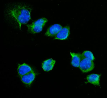 CD72 Rabbit Polyclonal Antibody