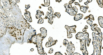 CDC123 Rabbit Polyclonal Antibody