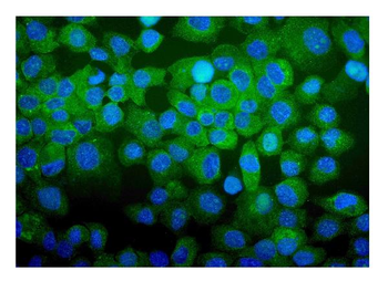 CDC123 Rabbit Polyclonal Antibody