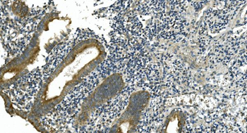 CDC123 Rabbit Polyclonal Antibody