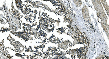 CDC123 Rabbit Polyclonal Antibody