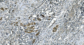 CDC123 Rabbit Polyclonal Antibody