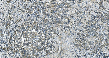 CDC123 Rabbit Polyclonal Antibody