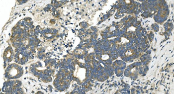 CDC123 Rabbit Polyclonal Antibody