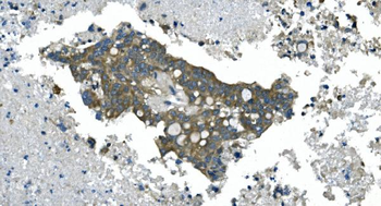 CDC123 Rabbit Polyclonal Antibody