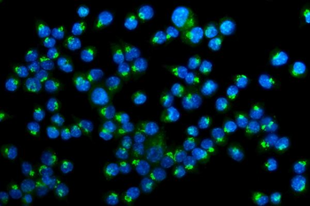 Golm1/GOLPH2 Rabbit Polyclonal Antibody