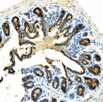 Golm1/GOLPH2 Rabbit Polyclonal Antibody
