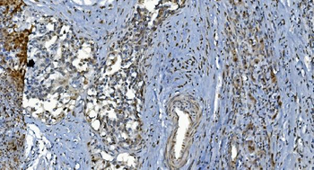 GRX2/GLRX2 Rabbit Polyclonal Antibody