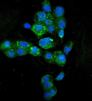 HYI Rabbit Polyclonal Antibody