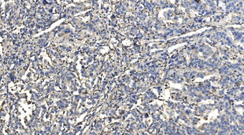 HYI Rabbit Polyclonal Antibody