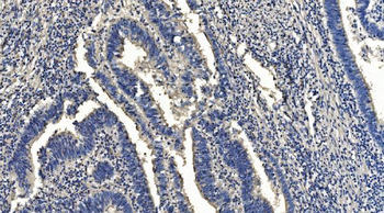 HYI Rabbit Polyclonal Antibody