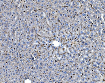 GILT/IFI30 Rabbit Polyclonal Antibody