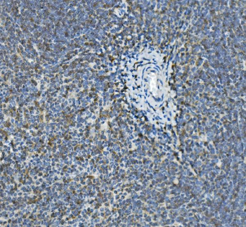 GILT/IFI30 Rabbit Polyclonal Antibody
