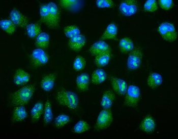 Galectin 2/LGALS2 Rabbit Polyclonal Antibody