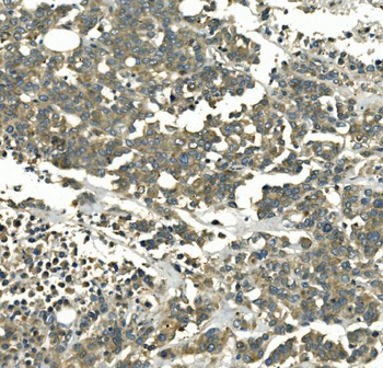 Galectin 2/LGALS2 Rabbit Polyclonal Antibody
