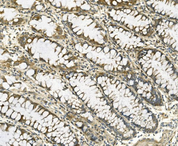 Galectin 2/LGALS2 Rabbit Polyclonal Antibody