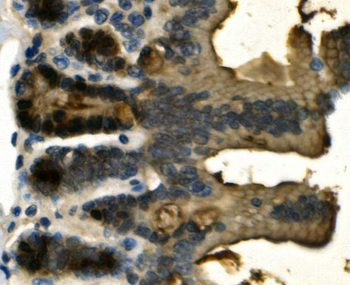 Galectin 2/LGALS2 Rabbit Polyclonal Antibody