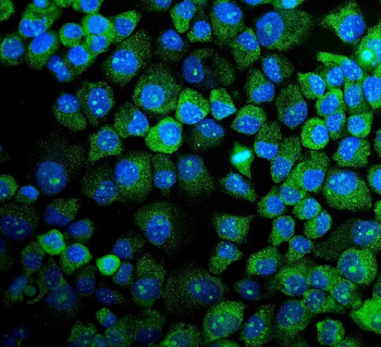 MAPK11 Rabbit Polyclonal Antibody