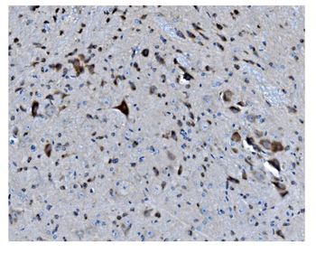 MAPK11 Rabbit Polyclonal Antibody