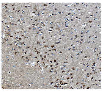MAPK11 Rabbit Polyclonal Antibody