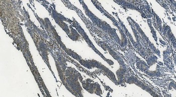 MAPK11 Rabbit Polyclonal Antibody