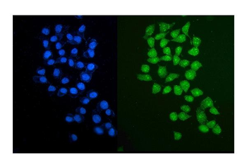 PARP2 Rabbit Polyclonal Antibody