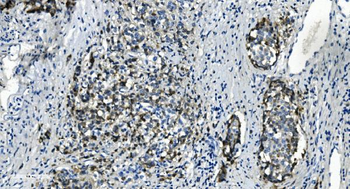 TMBIM1 Rabbit Polyclonal Antibody