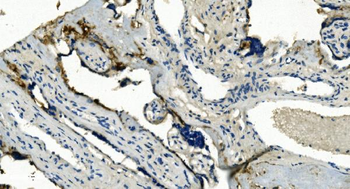 TMBIM1 Rabbit Polyclonal Antibody