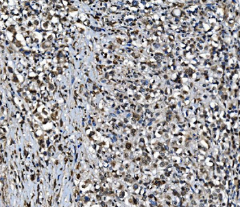 CDC27 Rabbit Polyclonal Antibody